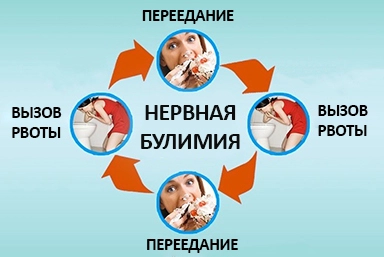 Лечение булимии в Нефтекамске